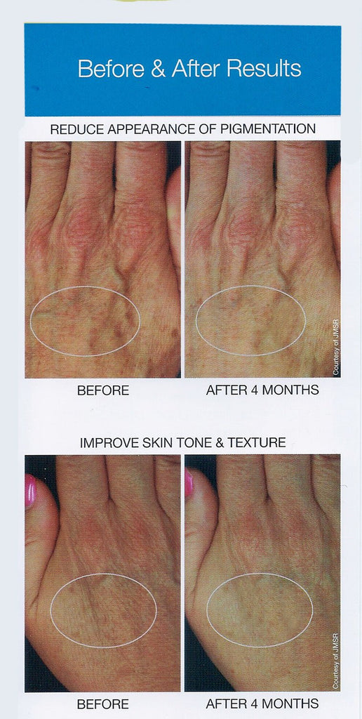Marini ReNu Corrective Hand Complex - ecologica Skincare of Malibu